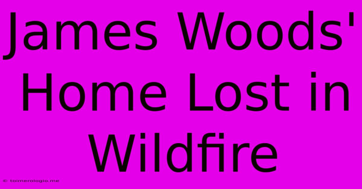 James Woods' Home Lost In Wildfire